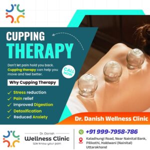 cupping therapy benefits